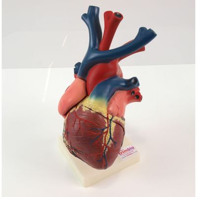 ESP Medical Heart Model