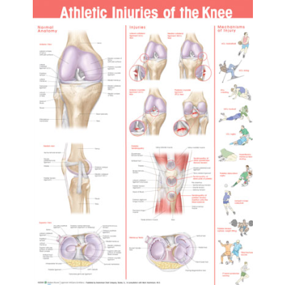 Athletic Injuries of the Knee Anatomical Chart 