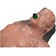 Vent Aid Resuscitation Device