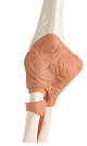 Functional Elbow Joint
